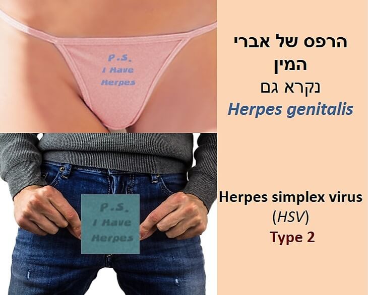 טיפ הרפס של אברי המין תמונת חצי גוף אישה בתחתונים וחצי גוף של גבר במכנסיים עם כיתוב יש לי הרפס Herpes genitalis